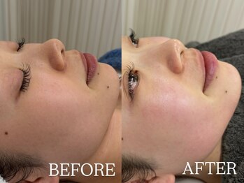 ラキ(LAKI)/フェイシャルワックス