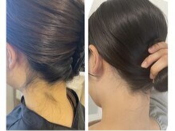 ミース 自由が丘店/うなじ矯正◆ビフォーアフター