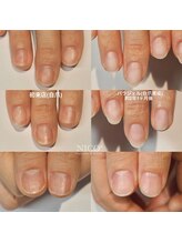 ニコプラス(NICO+)/自爪育成中