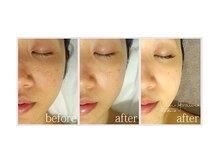 アン グレーヌ 自由が丘(unegraine)/輪郭スッキリ！洗練された女性に