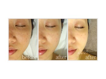 アン グレーヌ 自由が丘(unegraine)/輪郭スッキリ！洗練された女性に