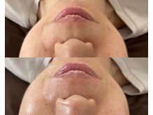 サロンドエピレーション トパーズ(Salon d’ epilation TOPARDS)/フェイスワックスだけで艶肌