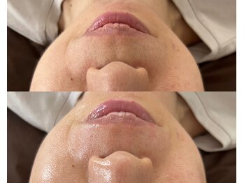 サロンドエピレーション トパーズ(Salon d’ epilation TOPARDS)/フェイスワックスだけで艶肌