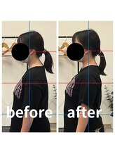 熊本カワル整体 JR上熊本駅院/巻き肩