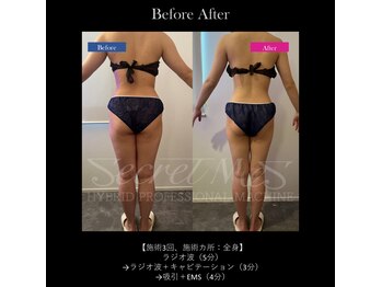 ミモサ 川中島温泉テルメDOME内(mimosa)/