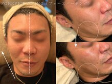 コアラル 麻布十番(COALALU)/CHRISTINAフォーエバーヤング