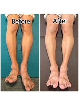 チェルシーストレッチ整体院/美姿勢は足から整える