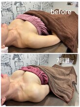 ロココ 豊田店(Rococo)/ビフォーアフター