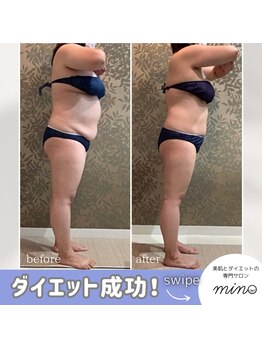 ミノ 美里大通り店(mino)/ダイエットパッケージプラン