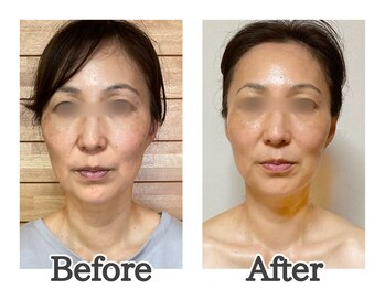 ハナハナ(hanahana)/