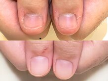 ジェルでオシャレも楽しみながら自爪を育てることができます