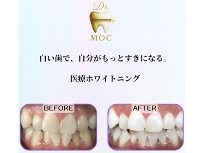 ドクターモック(Dr.MOC)の写真