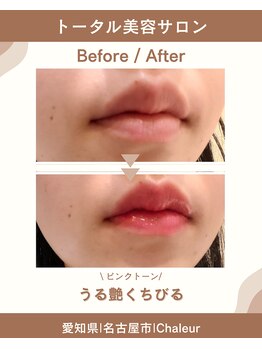 シャルール プラス(Chaleur+)/