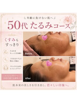 サロンドデュイの写真/肌、目覚める。ノーファンデを叶える◇加齢によるお悩みを解消しハリのあるツヤ肌に♪長年のお悩みも改善！