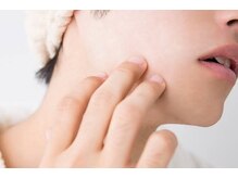 リリー(Lily)/【メンズ】ひげ脱毛