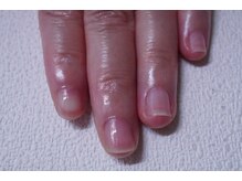 プチリリィ(Petit Lily)/最強のネイルケアスタートです！