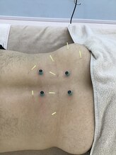 茨木いこい整体院