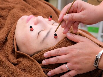 ネージュ鍼灸院(neige鍼灸院)/梅田/南森町/鍼灸◇美灸 特許