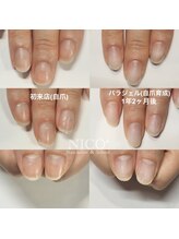 ニコプラス(NICO+)/自爪育成中