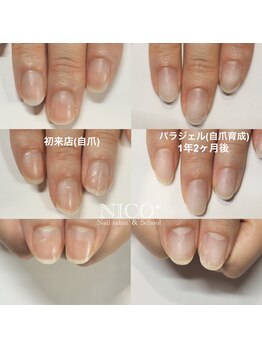 ニコプラス(NICO+)/自爪育成中
