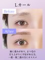 アイビーライン 藤沢(IVY-LINE)&nbsp;Lカール【Before→After】
