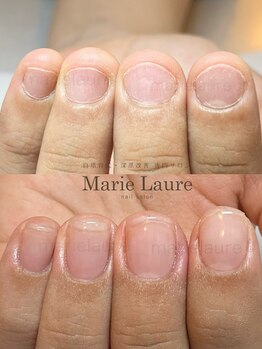 マリーロール 淀屋橋本店(Marie Laure)/自爪育成/深爪矯正/ネイルケア