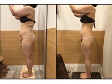 リッツ 所沢店/【Before/After】痩身