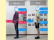 ナオル整体 大宮院(NAORU整体)/反り腰の姿勢を改善したい！