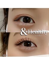 リノン(Linon)/&ヘルシ（マツエク）