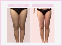 スリムライン 八戸店(The Slim Line)/before→after