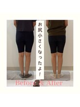 スタイルラボ高松/産後の骨盤矯正の効果♪