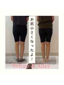 スタイルラボ高松/産後の骨盤矯正の効果♪