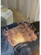 いつつのきの写真/寝ても抜けない疲れに。カッピングで巡りを促し、重だるさを流して休みやすい体へ導きます。今こそ。
