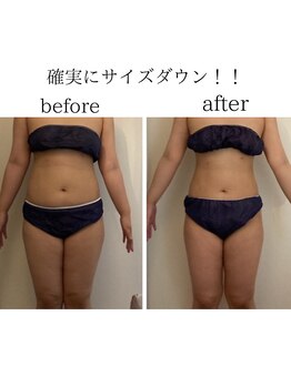 エリーズ(Elise)/全身キャビテーション