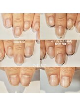 ニコプラス(NICO+)/自爪育成中