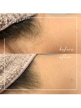 テンポフェリーチェ 浜松店(Tempo Felice)/浜松脱毛/都度払い/メンズ脱毛