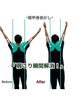 アサバ整体院 江戸川台店(ASABA整体院)/掲載記念限定・頑固な肩こり専用
