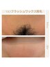 レディース【毛の悩み全て解決！】VIOフラッシュワックス脱毛 保湿付♪