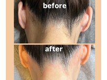 ジェンティル(Gentil)/小顔効果◎うなじワックス脱毛◎