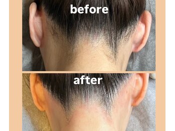 ジェンティル(Gentil)/小顔効果◎うなじワックス脱毛◎