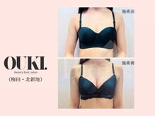 オウキ 梅田北新地(OUKI.)/バストアップ結果写真