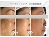 【ハーブピーリング】剥離しない肌質改善ハーブ★60分6000円