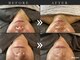 アングレイス(Anngrace)の写真