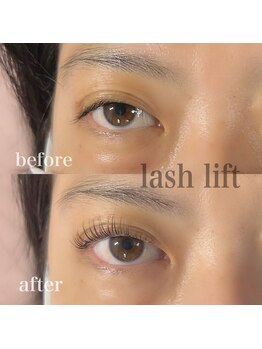 エミナル(EMINAL)/ラッシュリフト