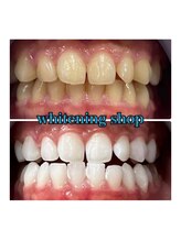 ホワイトニングショップ 所沢店/ホワイトニングショップ所沢店