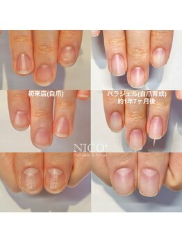 ニコプラス(NICO+)/自爪育成中