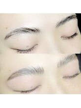 ビオエル(BIOEL)/