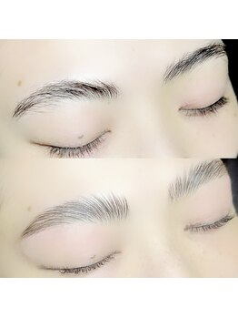 ビオエル(BIOEL)/