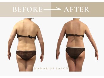 ママリスサロン(Mamariss Salon)/【痩身×デトックス 8回 】