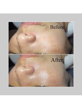 ブラックボックス(BLACK BOX)/ひたちなか市50代のお客様